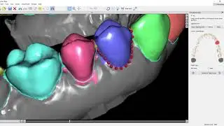 Phase 3 - Tooth Segmentation