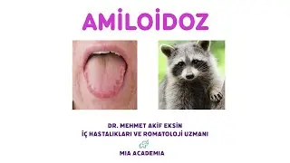 AMİLOİDOZ / SORULARLA KONU ANLATIMI - 4