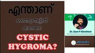 What is Cystic Hygroma in Babies?