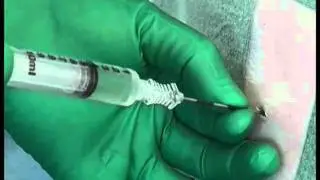 Rocket Medical Seldinger drain