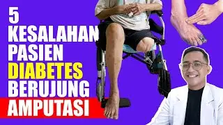 5 Kesalahan Pasien Diabetes yang Berujung Amputasi