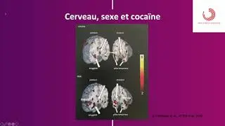 27 avril 2020 Mme GACE Isabelle 1&egrave;re vid&eacute;o Les sexualit&eacute;s addictives conf&eacute;rence