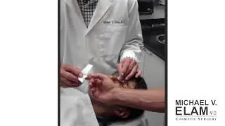 John N. Sees His New Nose From Dr. Michael Elam For the First Time #ElamFirstLook
