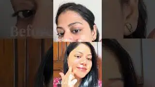 Zeelab 2% Hyaluronic Acid + 3% Vitamin B5 Face Serum | Deep Hydration & Glowing Skin