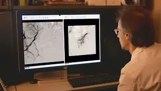 UVA Examining a Non-surgical Treatment for Enlarged Prostate Symptoms