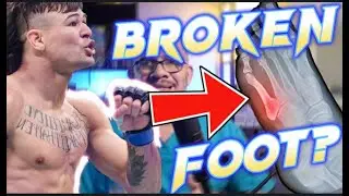 UFC 325 SHOCK: Did Diego Lopes Break Both Feet vs Volkanovski?