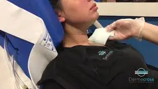 COOLSCULPTING PAPADA - CLINICA DERMACROSS