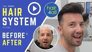 Before & After | Hair System | Non-Surgical Hair Replacement System for Men/Women | UK/USA/INTL