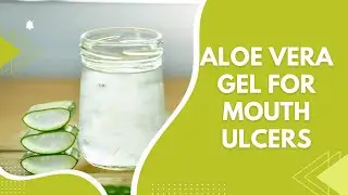 Aloe Vera Gel For Mouth Ulcers: 4 Comprehensive Benefits