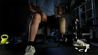 Life with a prosthesis - Episode #1