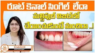 What is Best Single vs Multiple Visit Root Dental Treatment | Root Canal Treatment | Eledent Dental