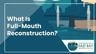 What Is Full-Mouth Reconstruction? | San Francisco East Bay Mini Dental Implants | Dr. Rose Magno