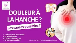Douleur à la hanche : CAUSES POSSIBLES ?