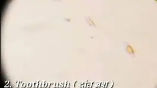 Toothbrush Under The Microscope