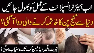 Breakthrough Medicine to End Baldness Worldwide | Forget Hair Transplants | Public News