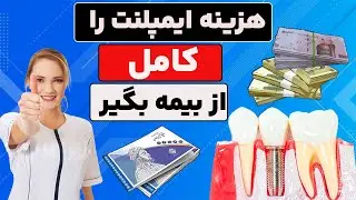 دریافت هزینه ایمپلنت دندان از بیمه بدون دردسر راهکارها و نکات کلیدی