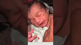 new crying after birth #viralshorts #cutebaby #viralvideo #baby 💯