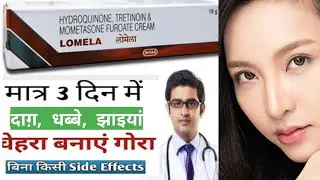Lomela Cream, Lomela Cream Ke fayde Aur Nuksan | Lomela Cream Review, Lomela Cream How To Use