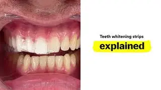 Hismile Whitening Strips Video 30sc