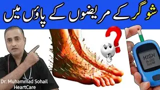 Pins & Needles in Diabetes | Numbness | Dr. Sohail