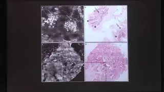 11   Introductiton  Concepts on Cellular Imaging &ndash; Dr Rajesh NG, JIPMER