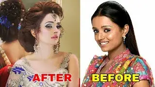 10 Plastic Surgery Of Popular TV Actress You Won't Believe