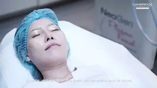 NeoGEN Nitro Plasma Facial