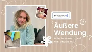 Mein Baby lag in Beckenendlage | Äußere Wendung | Erfahrungsbericht