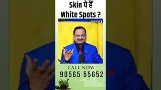 Skin पे हैं White Spots ? Subhash Goyal | Sadhna TV