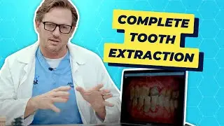 Full mouth dental implants. Trust Implants.