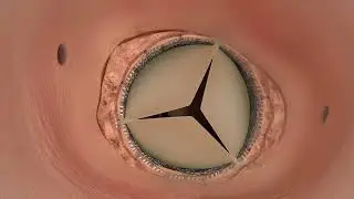 SAPIEN 3 Ultra RESILIA 手技アニメーション動画
