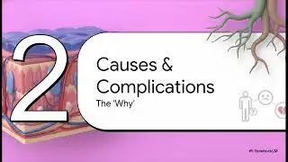 Buried Penis Explained: Causes, Hygiene & Treatments