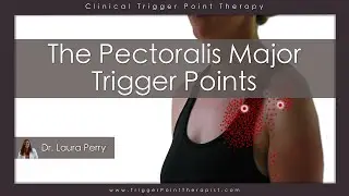 The Pectoralis Major Trigger Points