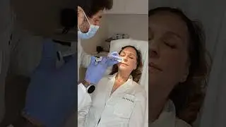 Mi experiencia con Profhilo