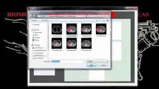 BIOMEDICAL ENGINEERING PROJECTS IDEAS
