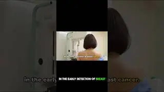 Screening for Breast Cancer