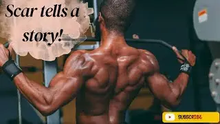 Scar tells a story! #motivation #transformyourlifetoday #lifecoach #newsong