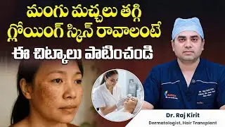 ముఖం మీద మంగు మచ్చలు పోవాలంటే ఏం చేయాలి? | Best Treatment for Melasma on Face | Celestee Clinic