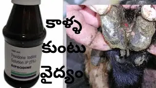 Leg pain treatment