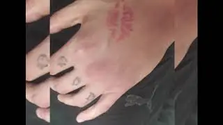 Eodo - A flor de piel