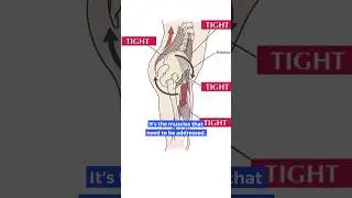 THIS hold the spine out of alignment