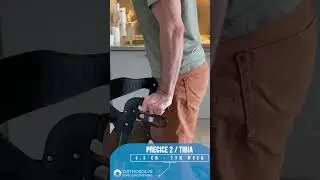 Orthosolve limb Lengthening