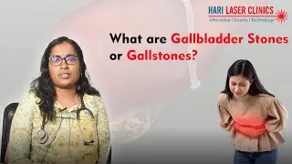 What are Gallbladder Stones or Gallstones? | Causes & Treatments of Gallbladder stones | Dr Prathiba