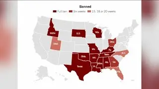 IN-DEPTH: A look at abortion laws across the US