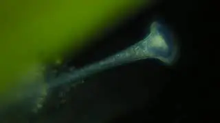 Stentor roeselii