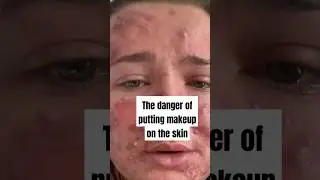 Stop wearing makeup before it's too late.