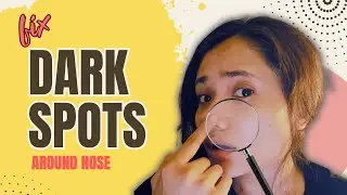 How To Fix Dark Spot Around Nose | Esthetician Tips