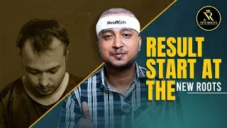 Grade 3 Baldness Hair Transplant in Kolkata | Cost, Procedure & Result | New Roots