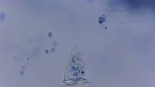 Vorticellidae