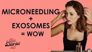 I Tried This Microneedling Facial With Exosomes &mdash; And The Glow Was Real